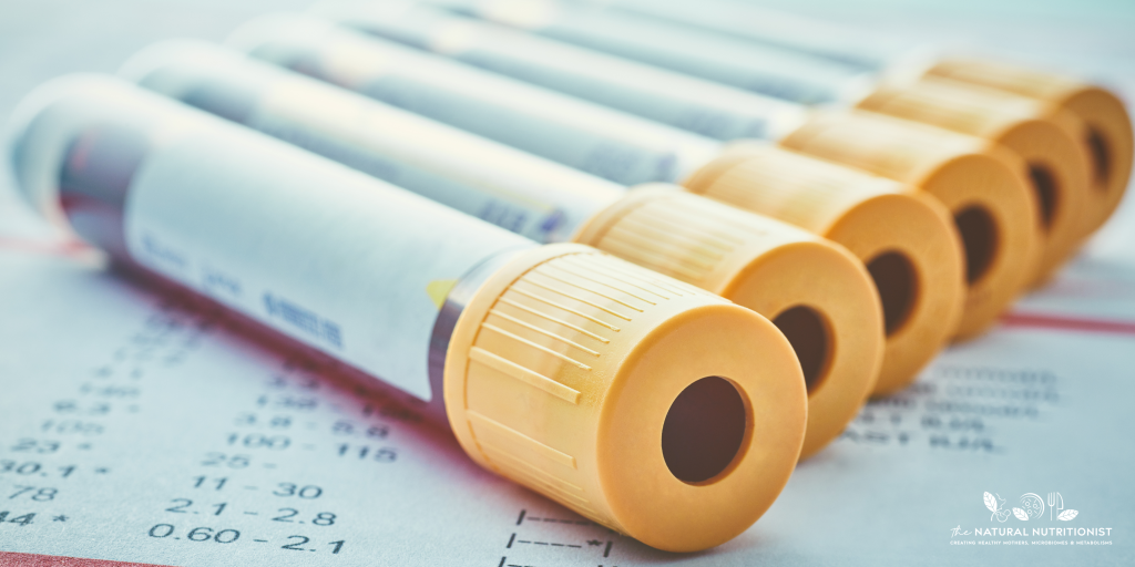 Natural Approaches to Lowering High Prolactin & Supporting the HPO Axis
